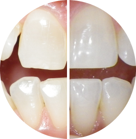 Before after image