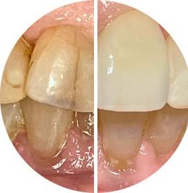 Before after image