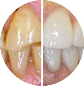 Before after image
