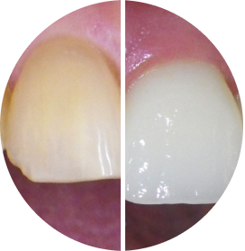 Before after image